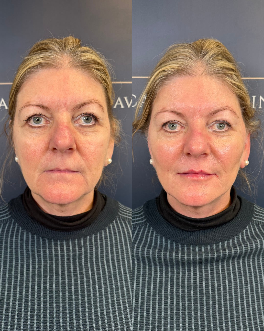 skincarescandinavia